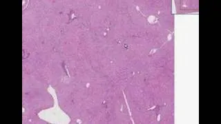 Histopathology Liver--Normal