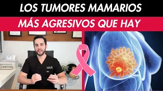 Tumores de mama más AGRESIVOS - CÁNCER DE MAMA Triple negativo - Her 2 neu