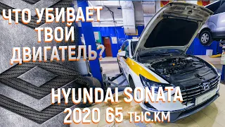 Повышенный расход масла G4NA Hyundai Sonata 2020