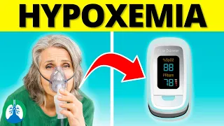 Hypoxemia | Causes, Symptoms, Diagnosis, and Treatment