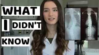10 things i didn’t know before scoliosis surgery