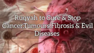 Very Powerful Ruqyah to Cure&Stop Renewing the Growth of Cancer, Tumours,Fibrosis&all Evil Diseases
