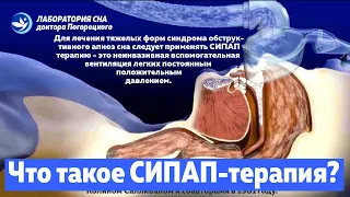 Что такое СИПАП-терапия (CPAP)?