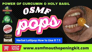 What is #OSMF Pops How to Use in #oralsubmucousfibrosistreatment #medicine, No Injection, No Surgery