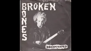 BROKEN BONES compilation 1