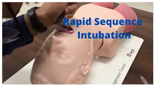 Rapid Sequence Intubation: What & how?