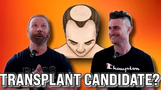 What kind of Hair Transplant Candidate are you? (Ft. Bobby Dunlap)