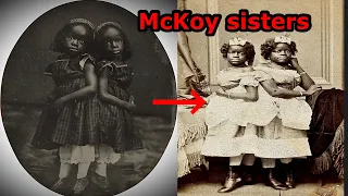 The horrific story of enslaved conjoined twins exhibited in a circus McKoy sisters