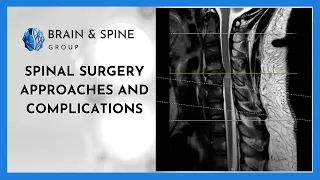 Spinal Surgery Approaches and Complications