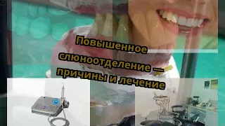 Повышенное слюноотделение — причины и лечение