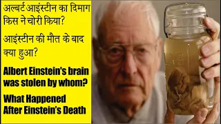 Albert Einstein's brain was stolen by whom -- Albert Einstein Ka Dimaag kis Ne chori kia