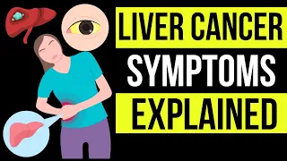 Doctor explains potential SIGNS AND SYMPTOMS of LIVER CANCER | plus causes, prevention & treatment