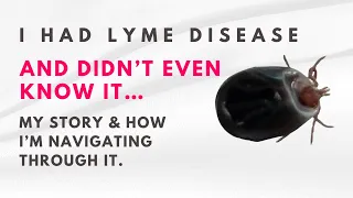 My Lyme Story | One Tick Bite…3 Autoimmune Diseases Later😩 | I Had Lyme & Didn’t Even Know it😳