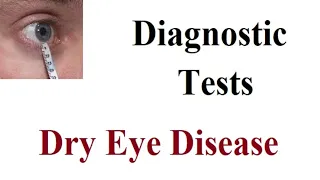 Diagnostic Tests for Dry Eye Disease