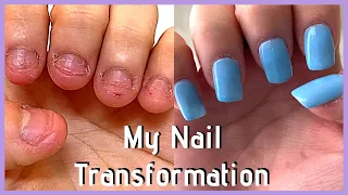 UPDATE: My FAST Nail Transformation in 2020 (nail journey part 5)