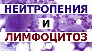 Нейтрофилы понижены лимфоциты повышены. Лейкоцитарная формула крови. Нейтропения Лимфоцитоз.