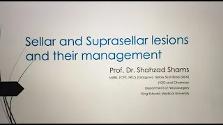 Prof Shahzad Shams - Sellar and Suprasellar Lesions and their management at KEMU, Lahore Pakistan