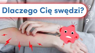 Dlaczego Cię swędzi? Świąd – mechanizm i przyczyny powstawania.