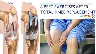 8 Best Exercises After Total Knee Replacement #Rehabilitation After TKR #Home Exercises After TKR