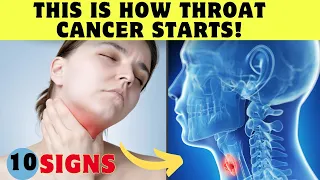 This is How Throat Cancer STARTS and No One Tells You - Symptoms