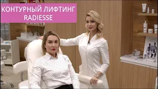 Контурный лифтинг Radiesse