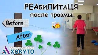 🦶Реабилитация до и после!! После перелома лодыжек✨✨✨