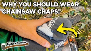 This Is Why You Should Wear Chainsaw Chaps!