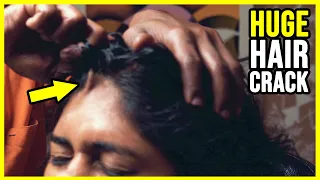 *HUGE* HAIR CRACK 🟠 INDIAN HEAD MASSAGE with FIRE 🟠 ASMR SLEEP