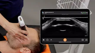 Ophthalmic Ultrasound