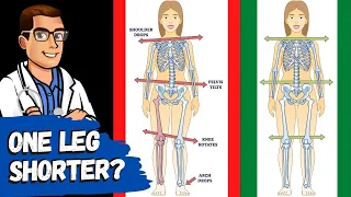 One Leg Longer than the Other Pain? [FIX Leg Length Discrepancy & LLD]