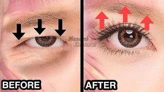 9mins Big Eyes Massage (Fast Results) | Lift Droopy Eyelids, Make Your Eyes  Bigger