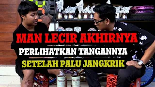 NGERI!! MAN LECIR AKHIRNYA PERLIHATKAN TANGANNYA YANG LUMPUH PASCA ADU JANGKRIK