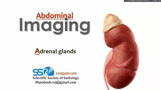 13 Adrenal gland Imaging -  Prof.Mamdouh Mahfouz (2019 edition)