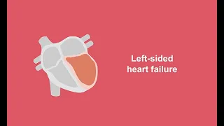 Classifying left-sided heart failure