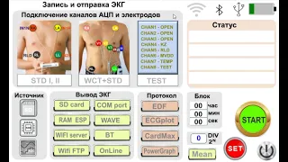 Схемотехника ЭКГ. ч.5. ADS1299: прибор CardIOT-Test