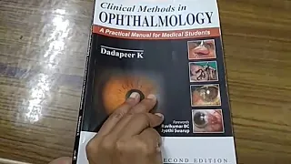 Ophthalmology Practical Book Exam History Taking Case Presentation Review Dadapeer k clinical viva