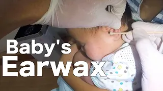 2 Month Old Baby's Ear Cleaning | Look ! What's Removed From Baby's Ear