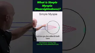 What is simple Myopia (Nearsightedness)?