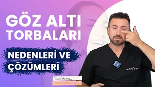 Göz Altı Torbalarının Ameliyatsız Çözümleri