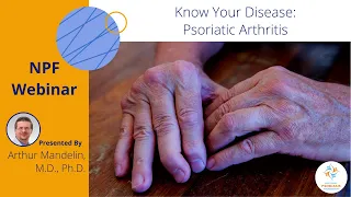 Know Your Disease:  Psoriatic Arthritis
