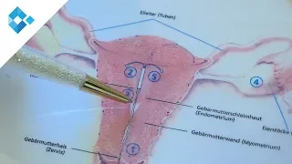 Hormonelle und nicht-hormonelle Verhütungsmethoden | Dr. Rohrbacher