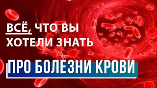 Гематологя – Кто болеет раком кожи? / Диагностика онкологии / Как предупредить болезни крови?