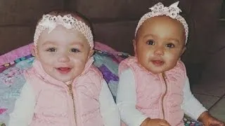 Twin babies have different skin colors