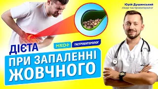 ДІЄТА ПРИ ЗАПАЛЕННІ ЖОВЧНОГО МІХУРА. Як лікувати холецистит? Причини, симптоми, діагностика