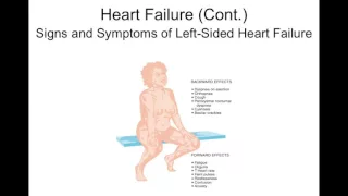 Chapter 19 Heart Failure and Dysrhythmias BIOL300