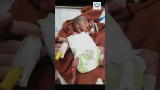 Premature Baby of about 24 Weeks | Doctor Xydi