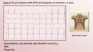 EKG and Heart Murmur Review - Part 1