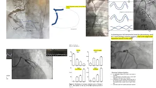 Interesting coronary angiograms -2