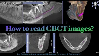 How to read CBCT images?