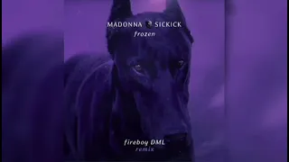 Madonna Vs Sickick - Frozen [Fireboy DML Remix] (Official Audio)